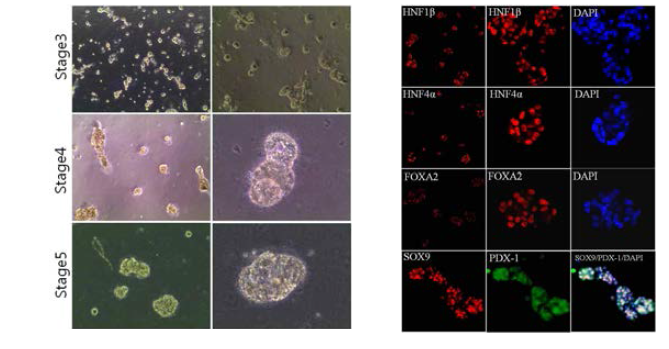 내배엽전구세포주로부터 췌장전구세포 (pancreatic progenitor cells)로의 분화