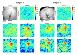 서로 다른 시간(0.5초, 1초, 2초, 5초)의 vibrotactile 자극(25Hz)에 대한 S1의 활성화(optical imaging): 자극 제시 시간이 길어질수록 활성 위치에서의 활성도는 커지고 활성 위치 주위가 inhibition됨