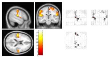 3초 압력 자극에 대한 뇌 활성 패턴 (p<0.05, FWE-corrected, F-score)