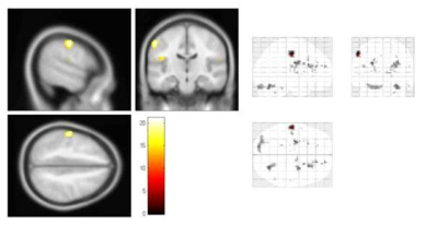 9초 압력 자극에 대한 4~6초까지의 뇌 활성 패턴 (p<0.05, FWE-corrected)