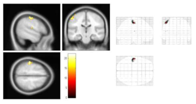 15초 압력 자극에 대한 7~9초까지의 뇌 활성 패턴 (p<0.05, FWE-corrected)