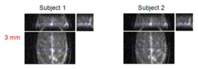 피험자 두 명을 대상으로 해상도 in-plane 3mm²resolution의 fMRI 영상