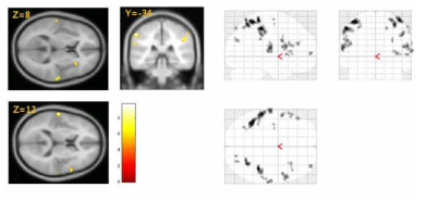 검지의 온도 자극에 대한 뇌 활성 패턴 (group analysis, fixed effect, p<0.05, FWE-corrected)