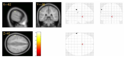 소지의 온도 자극에 대한 뇌 활성 패턴 (group analysis, fixed effect, p<0.05, FWE-corrected)