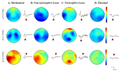 C3 채널에서의 동역학, 레이저, 온감 자극에 의한 Alpha band(위)와 Beta band(중간, 아래)의 ERD/ERS가 발생하는 특정 latency의 topography