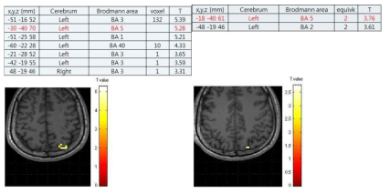 Uncorrected 0.001<p로 EPI와 RASER의 fMRI 데이터 분석 결과