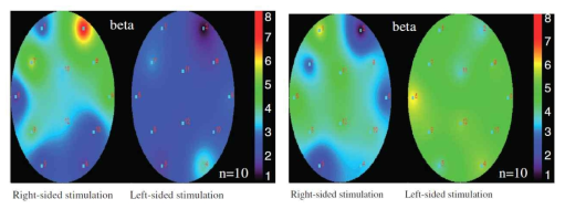 압감 제시에 따른 beta band에서의 Significant probability mapping(SPM)