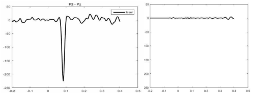 레이저 플라즈마에 의한 노이즈 발생 전 EEG 신호(좌)와 Adaptive filter를 이용해 노이즈가 제거된 후 EEG 신호(우)