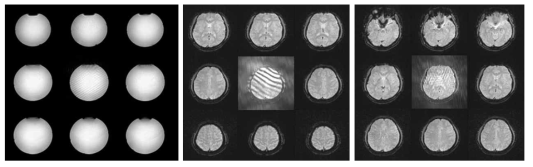 Phantom 영상의 노이즈(좌)와 Human brain에서의 노이즈(가운데, 우) 비교 (정 가운데 위치한 스캔이 노이즈 영향을 받은 스캔)