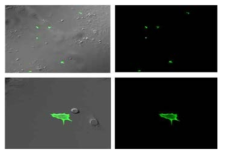 Confocal 현미경을 통한 Merkel cell 확인. 녹색으로 발광하는 세포가 Merkel cells. ((위) 200X,(아래) 200X Zoom5)). 그 외, 발광하지 않은 세포는 Merkel cells과 같이 배양된 Keratinocyte.