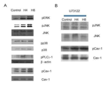 세포 신전(stretch) 시, PLCr-1, Cav-1을 비롯한 관련 단백질의 인산화가 일어남을 보이는 Western blotting 실험 결과