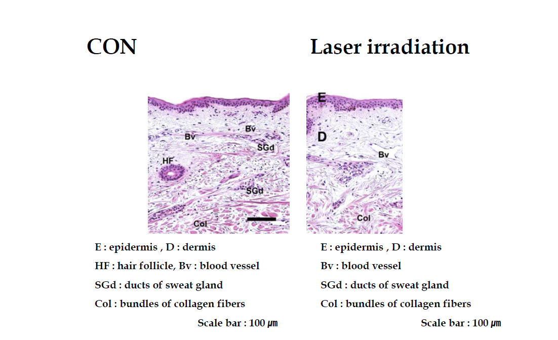 왼쪽 대조군, 오른쪽 레이저 조사 후 피부 표본. 차이가 없음