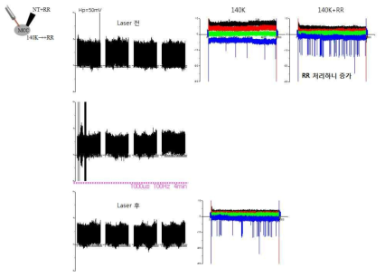 Ruthenium Red 의 side 효과와 laser로 인한 채널활성화는 감소