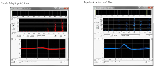 기계적 자극에 따른 Abeta-신경섬유의 반응 (느린 적응 신경섬유와 빠른 적응 신경섬유)