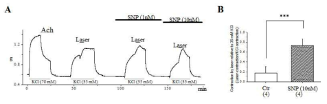 SNP(NO donor) 전 처리 후 레이저에 의한 혈관 수축이 농도 의존적으로 증가함.