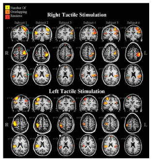 왼쪽 손과 오른쪽 손에 brush를 통한 가벼운 압력의 촉각 자극을 제시하였을 경우 이에 대한 뇌의 활성 영역