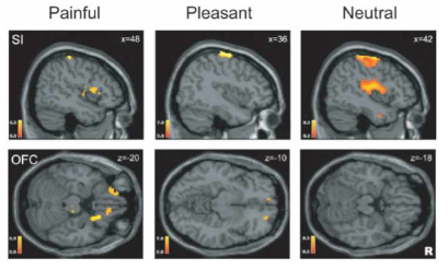 질감 자극에 반응하는 뇌의 활성 영역 및 질감 자극의 세기에 따른 활성도 (SI: primary somatosensory cortex, OFC:orbitofrontal cortex)