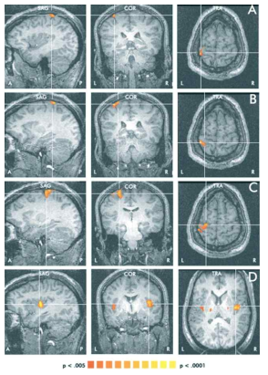 각 자극에 따른 대뇌 피질의 GLM maps. 모양(A), 질감 (B), 그리고 경도 (C)