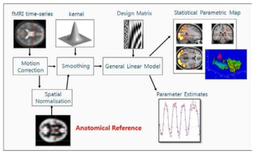 뇌 기능 영상 분석 flow chart (K. Friston, Statistical parametric Mapping)