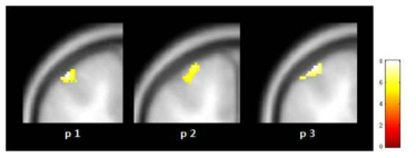 검지(d2)의 somatosensory cortex 영역 활성화