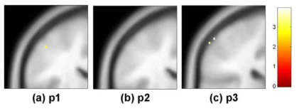 중지(d3)의 somatosensory cortex 영역 활성화