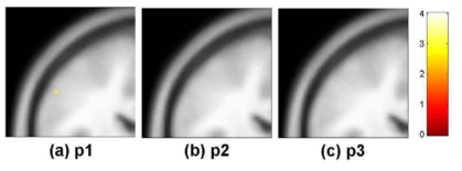 약지(d4)의 somatosensory cortex 영역 활성화