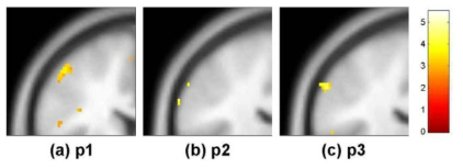 소지(d5)의 somatosensory cortex 영역 활성화