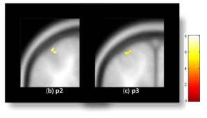 검지(d2)의 somatosensory cortex 영역 활성화