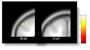 중지(d3)의 somatosensory cortex 영역 활성화