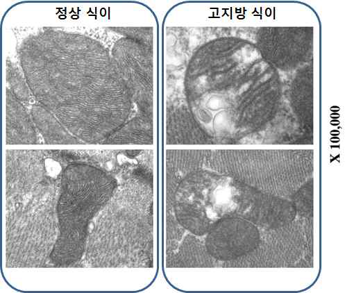 대사 스트레스에 의한 골격근 미토콘드리아 구조 변화