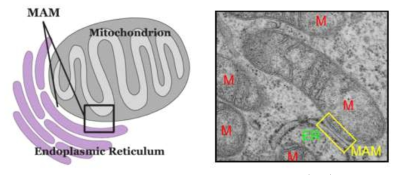 미토콘드리아-연관 소포체막 (MAM)