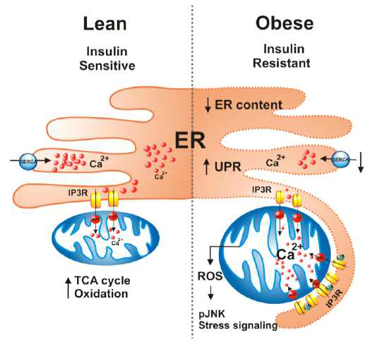 비만 상태에서 미토콘드리아-연관 소포체막 증가에 의한 인슐린 저항성 발생 모델