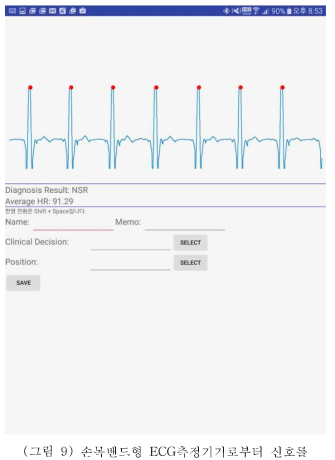 손목밴드형 ECG측정기기로부터 신호를 측정하여 부정맥을 자동 진단하는 앱