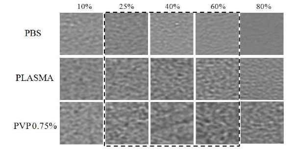 Speckle image of blood at different hematocrit levels in various media.