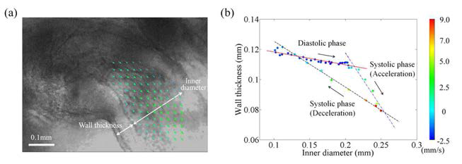 (a) Velocity field in the OFT of a chick embryonic heart and morphological wall properties. (b) Relationship between wall thickness and vessel diameter in a cardiac cycle. Velocity magnitude is depicted in color.