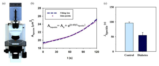 (a) Schematic diagram of a new microfluidic diagnosis method for measuring red blood cell (RBC) aggregation based on autocovariance function. (b) Temporal variation of speckle area (λSpeckle) with the lapse of time. Characteristic time (λSpeckle) of speckle area represents the time required to form RBC aggregates. (c) Comparison of characteristic time (λSpeckle) between control and diabetic rat models.