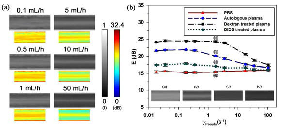 (a) Speckle images of blood flows at different flow rates. For easy comparison, the corresponding images with false colors representing in decibels are included. (b) Variations of mean echogenicity (E) in the center of the tube (ranged from −0.25 to 0.25 of normalized radius) according to pseudo shear rate.