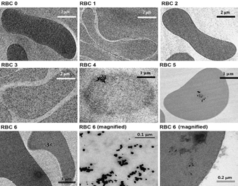 TEM images of the RBCs embedded with gold nano particles