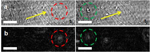 (a) Bright-field images of T-cells and endothelial layers captured by consecutive recordings. Only endothelial cells (yellow arrows) and a T-cell adhered to the endothelial cells (green circle) are clearly observed; a flowing T-cell is not observed (red circle). (b) Reconstructed hologram image at the same location in bright-field image at different planes. T-cell attached to the endothelial cell and a flowing T-cell are shown. Scale bars, 20 μ m.