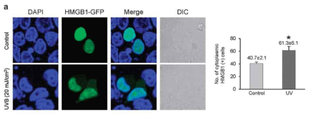 결막상피 유래 세포주에서 자외선 조사에 의해 유도되는 HMGB1의 핵-세포질 이동