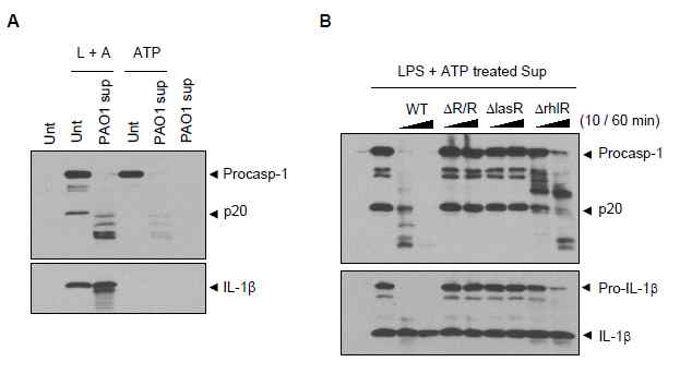 Quorum sensing 특이적 인플라마좀 성분의 분해