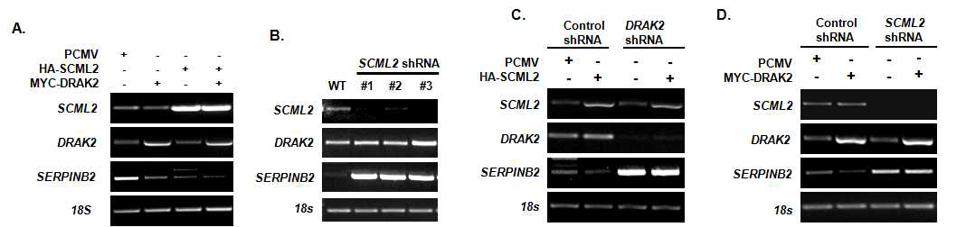 DRAK2와 SCML2 단백질 발현 차이에 따른 종양형성 억제 유전자 SERPINB2 발현 조절 분석