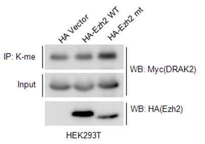 EZH2 단백질에 의한 DRAK2 단백질의 메틸화 분석