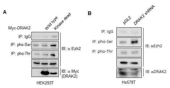 DRAK2 단백질의 kinase 활성 및 발현 수준에 따른 EZH2 단백질의 인산화 분석