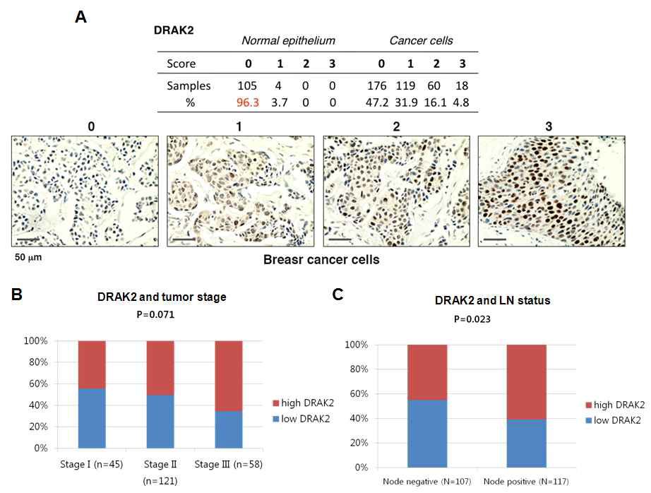 국내 유방암 환자 TMA에서 DRAK2 단백질의 발현 분석