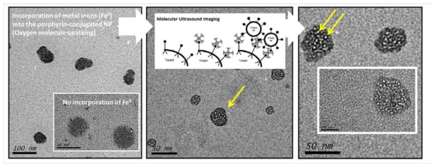 Porphyrin-conjugated PHEA 에 Fe 도입한 후 산소분자가 결합된 나노세포의 TEM 결과