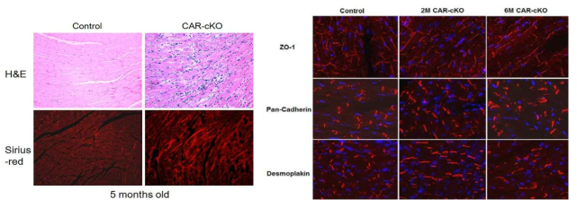 CAR 제거 mouse 심장의 조직병리학적 변화.