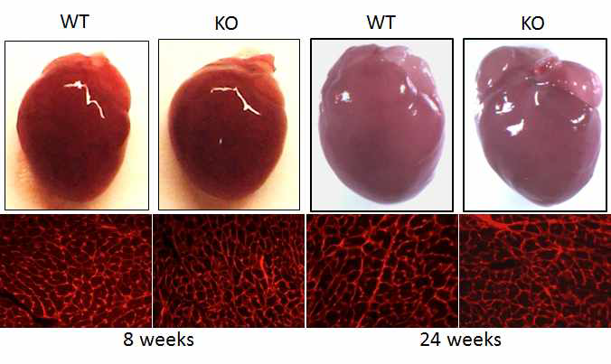 심근세포 특이적 CAR 단백질 제거 생쥐의 심근세포 크기변화와 심장 기능유지.