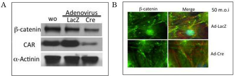 배양심근 세포에서 CAR 단백질 제거에 의한 β-catenin 파괴. Cre-LoxP system을 사용한 돌연변이 배양심근 세포에 아데노바이러스 시스템을 사용하여 Cre 단백질을 과 발현시켜 CAR 단백질을 제거하였다.