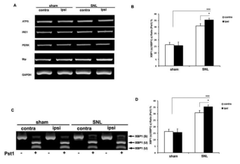 The mRNA level in the spinal dorsal horn following on postsurgery day 14.